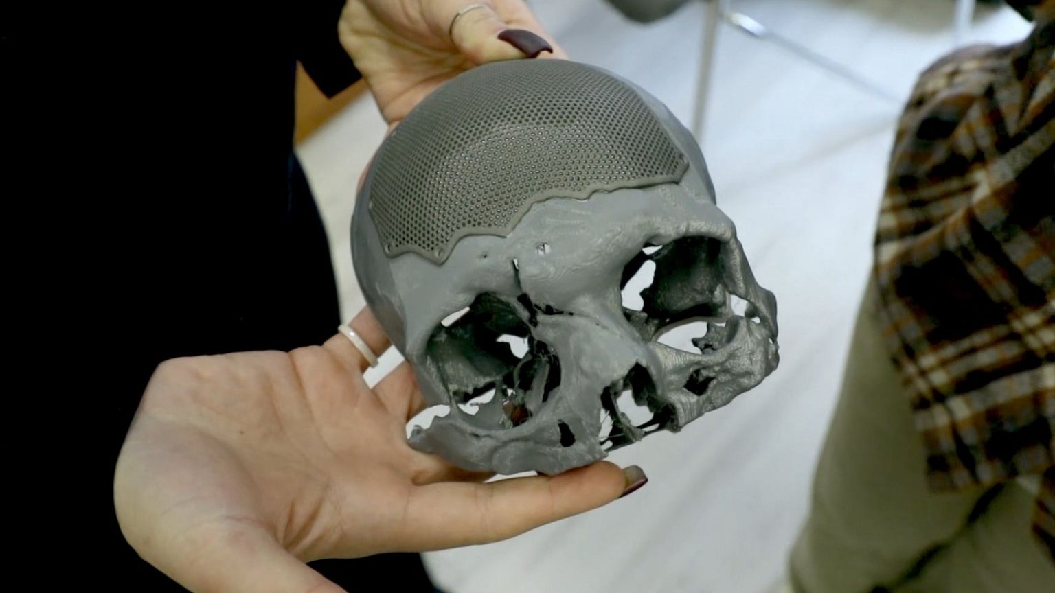 Les opérations de reconstruction faciale sont financées par la fondation Doctors for Heroes.